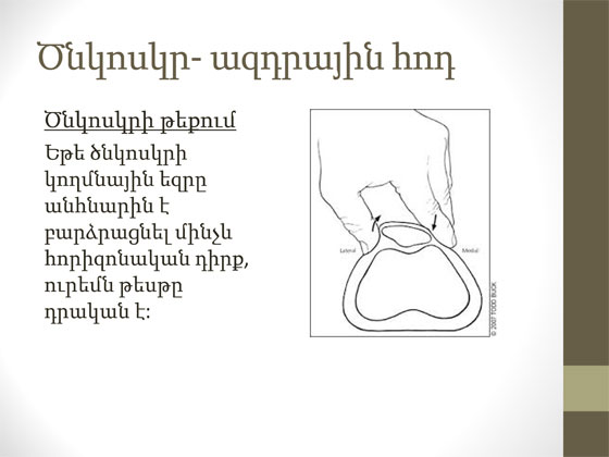 ծնկի հոդի կլինիկական հետազոտություն