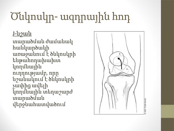 ծնկի հոդի կլինիկական հետազոտություն