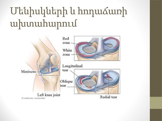 ծնկի հոդի կլինիկական հետազոտություն